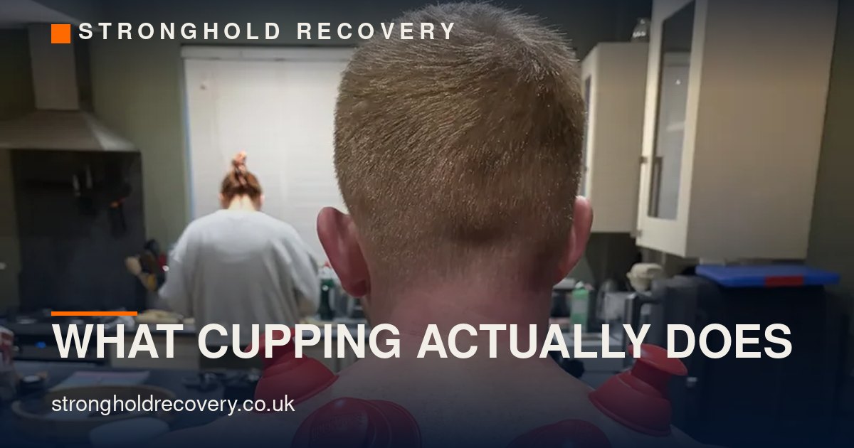 What is cupping, and does it actually work?